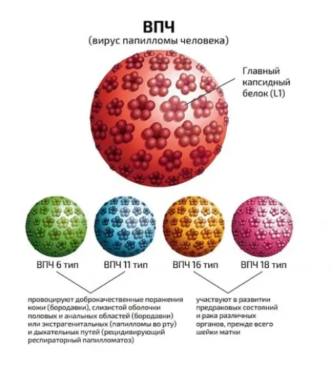 Папіломи статевих органів