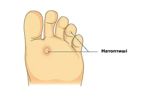 натоптиші