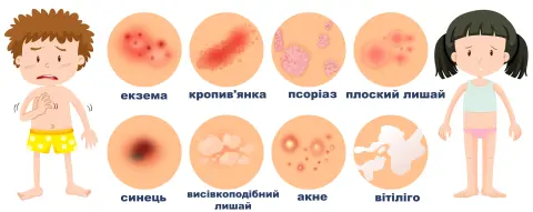 види плям на шкірі у дитини